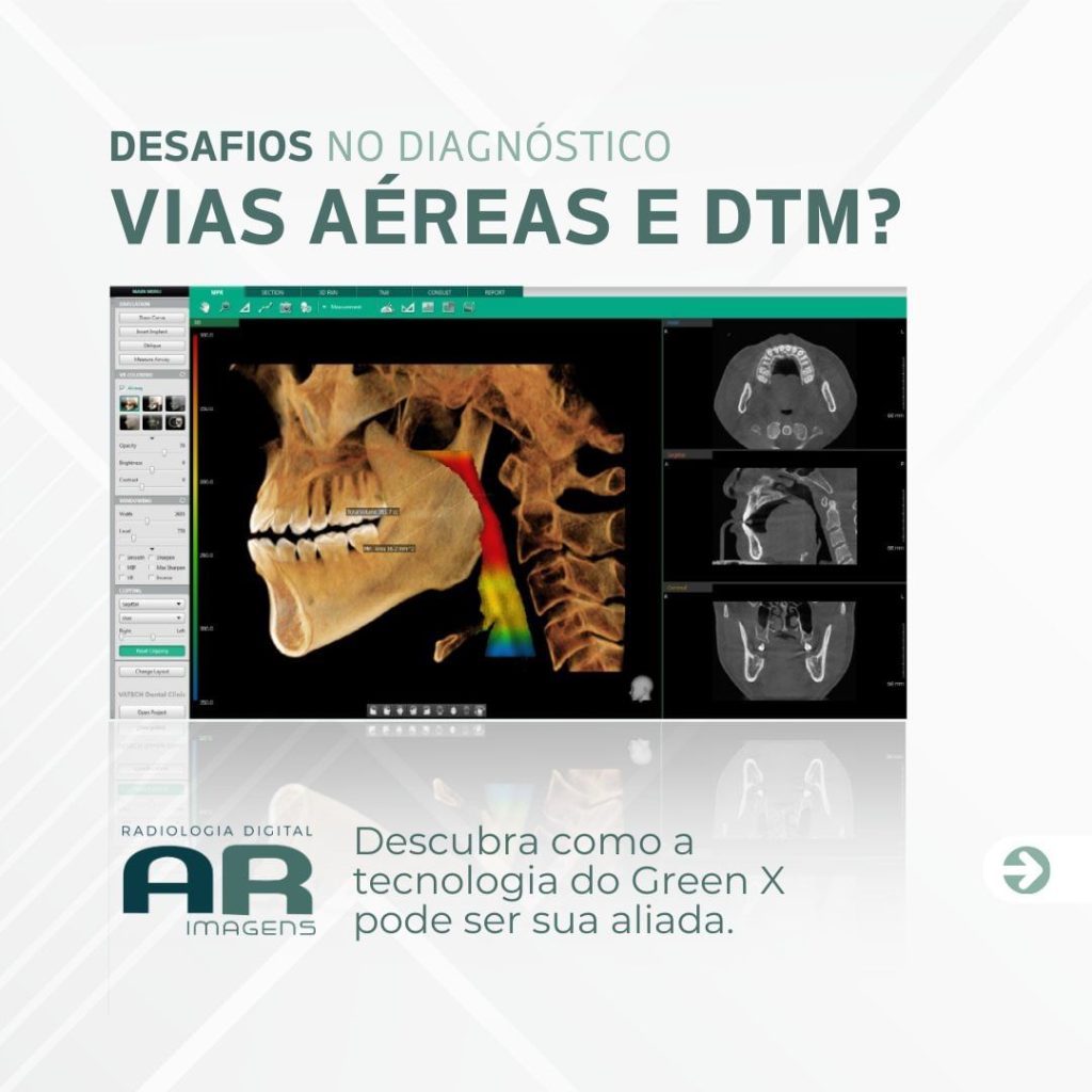 diagnostico-de-vias-aereas-e-dtm