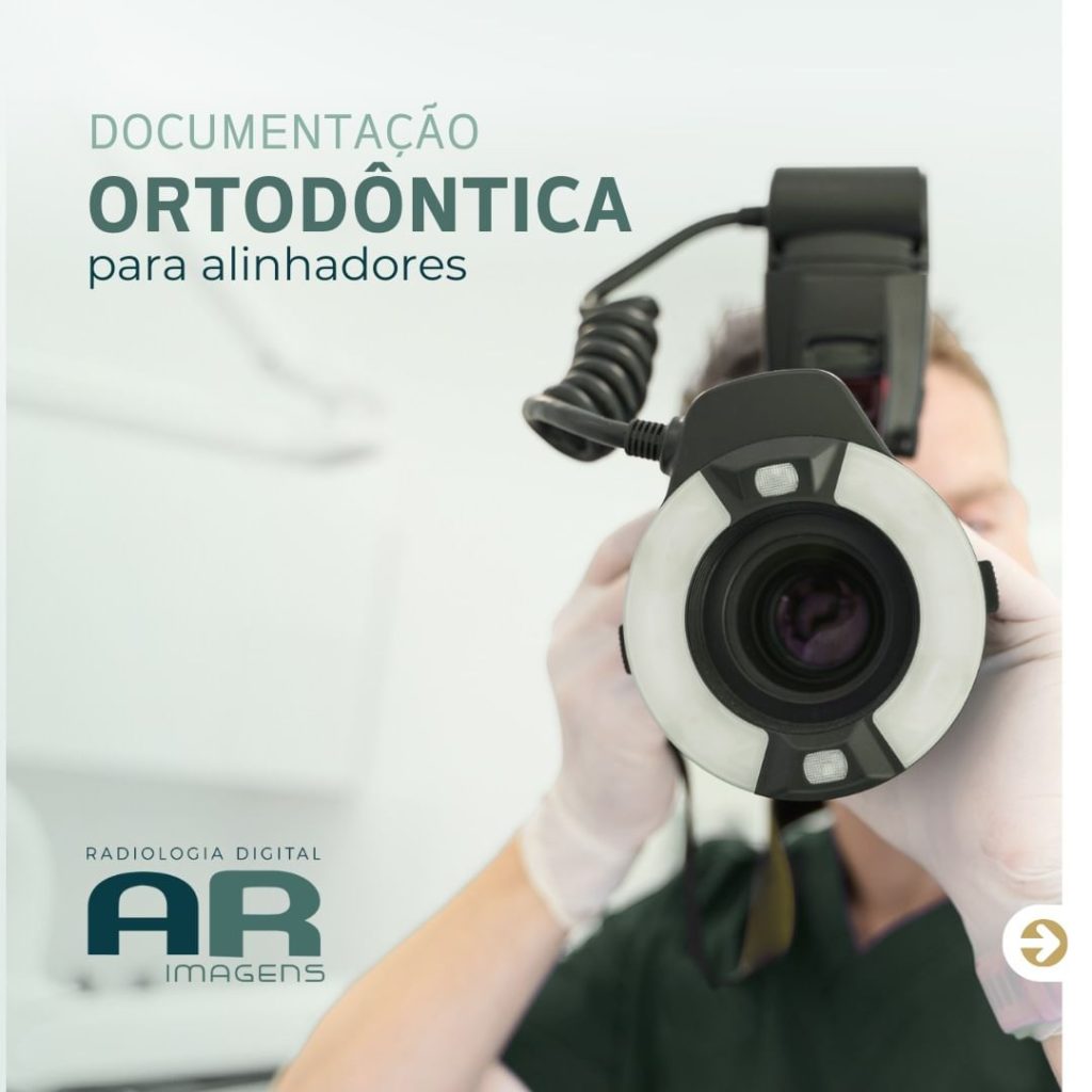 documentacao-ortodontica-para-alinhadores