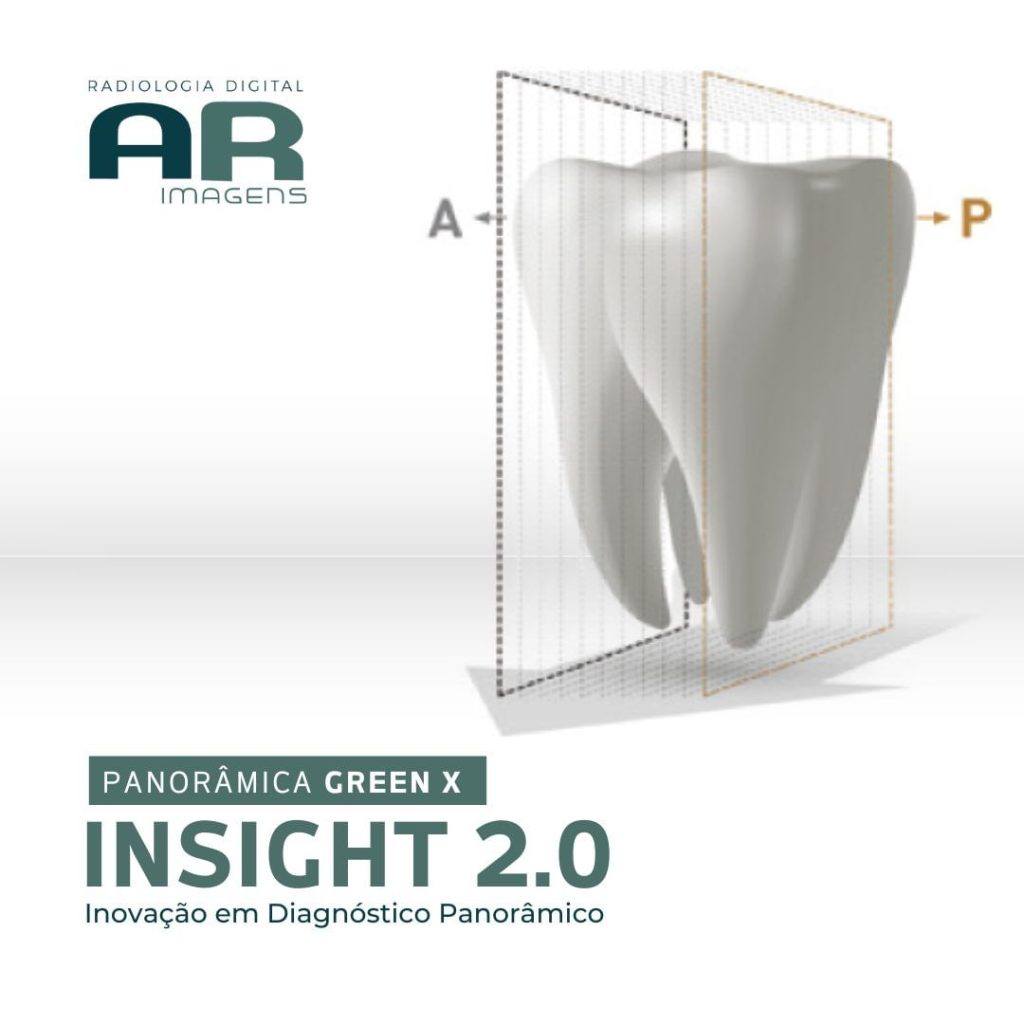 panoramica-green-x-insight-2-0