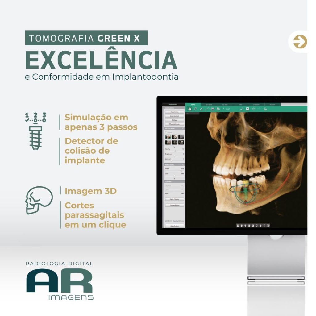 excelencia-na-tomografia-green-x