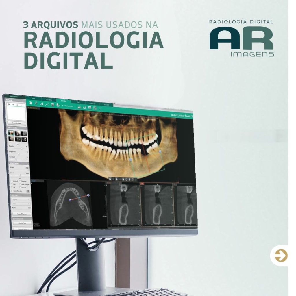 3-arquivos-mais-usados-na-radiologia-digital