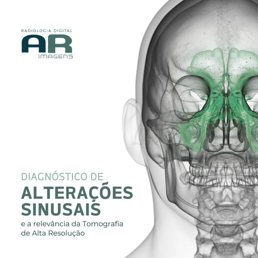 diagnostico-de-alteracoes-sinusais