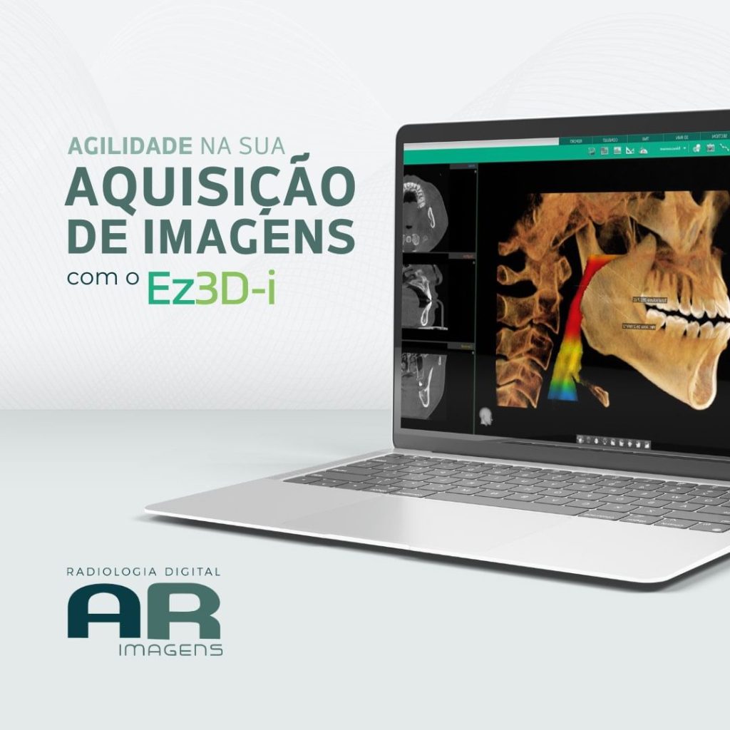 aquisicao-de-imagens-com-o-ez3d-i