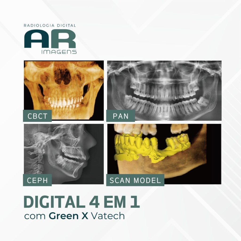 digital-4-em-1