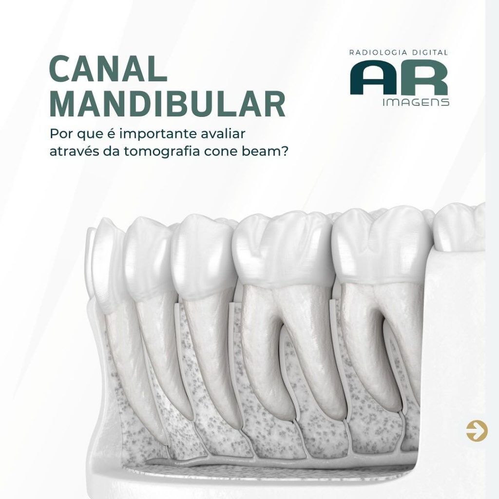 canal-mandibular