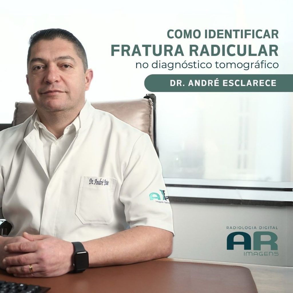 como-identificar-fratura-radicular