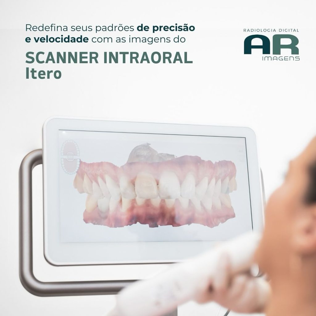 scanner-intraoral-itero