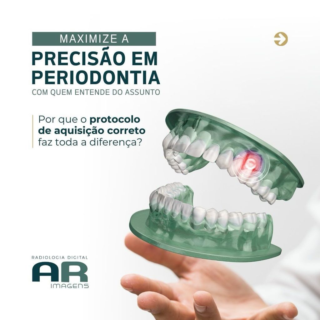 maximize-a-precisao-em-periodontia