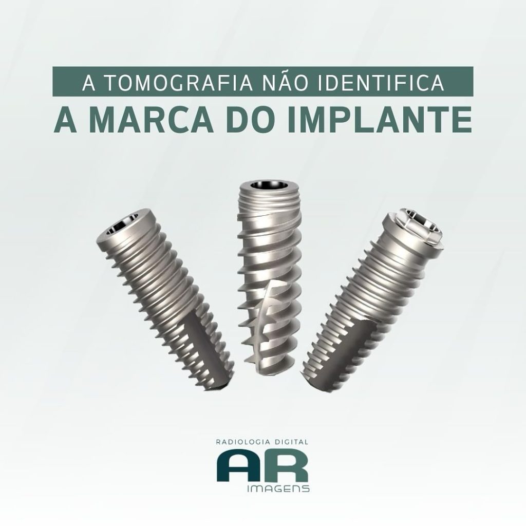 a-tomografia-nao-identifica-a-marca-do-implante