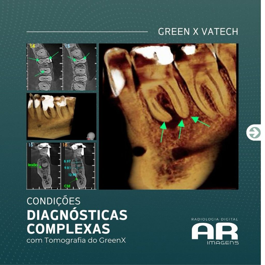 condicoes-diagnosticas-complexas