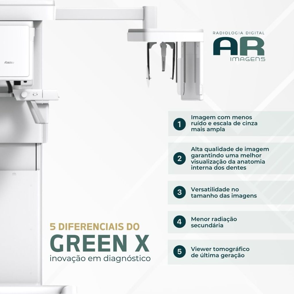 5-diferenciais-do-green-x