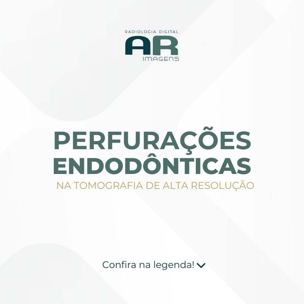 perfuracoes-endodonticas