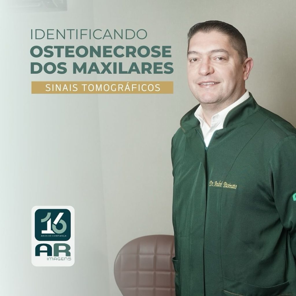 identificando-osteonecrose-dos-maxilares