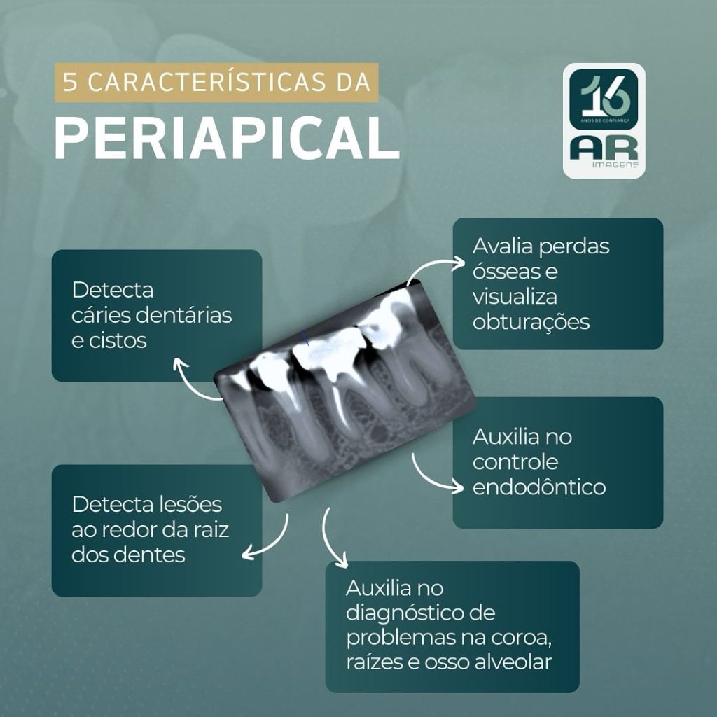 5-caracteristicas-da-periapical