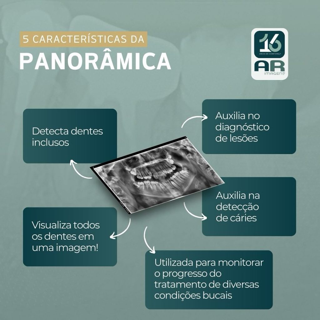 5-caracteristicas-da-panoramica