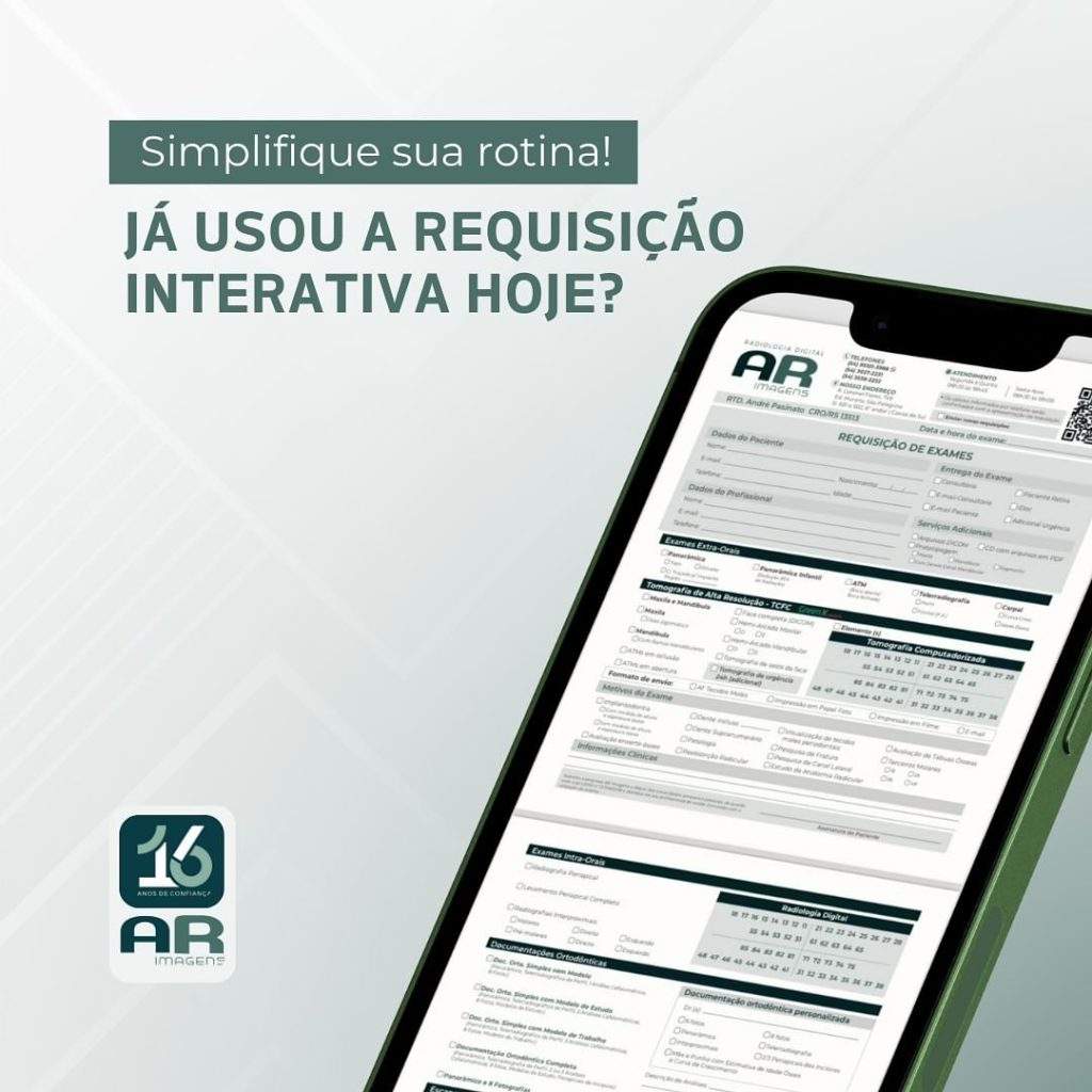 ja-usou-a-requisicao-interativa-hoje-?