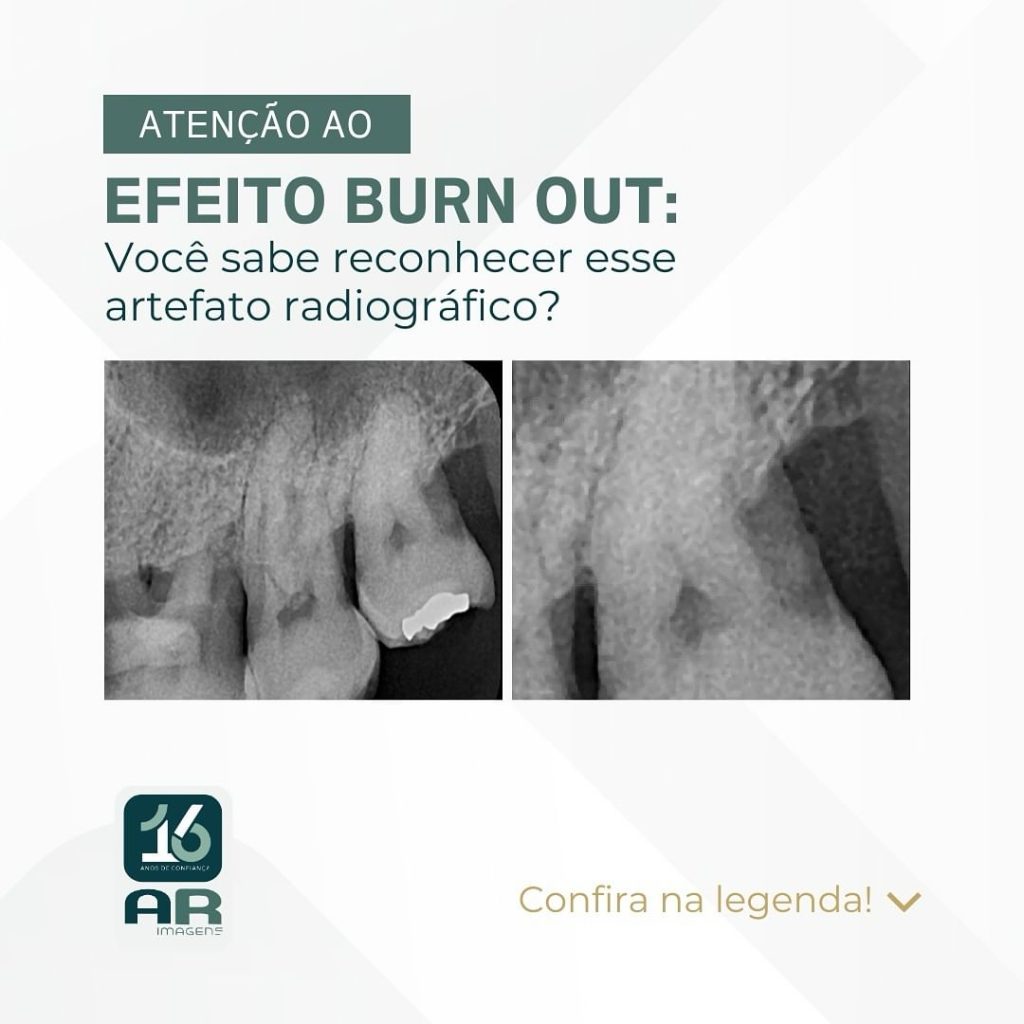 efeito-burn-out