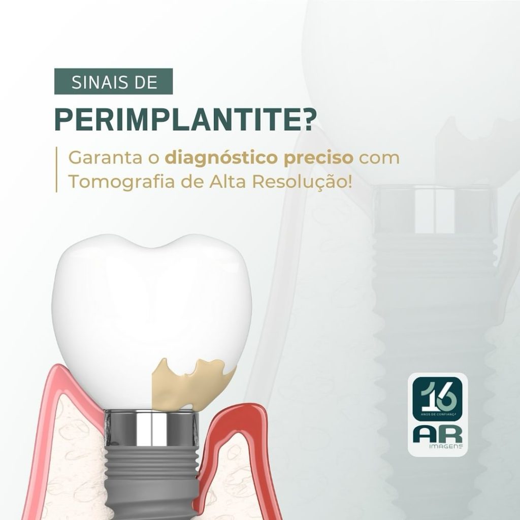 sinais-de-perimplantite