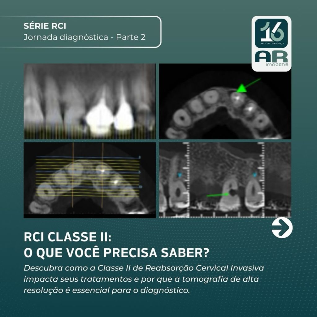 rci-classe-ii