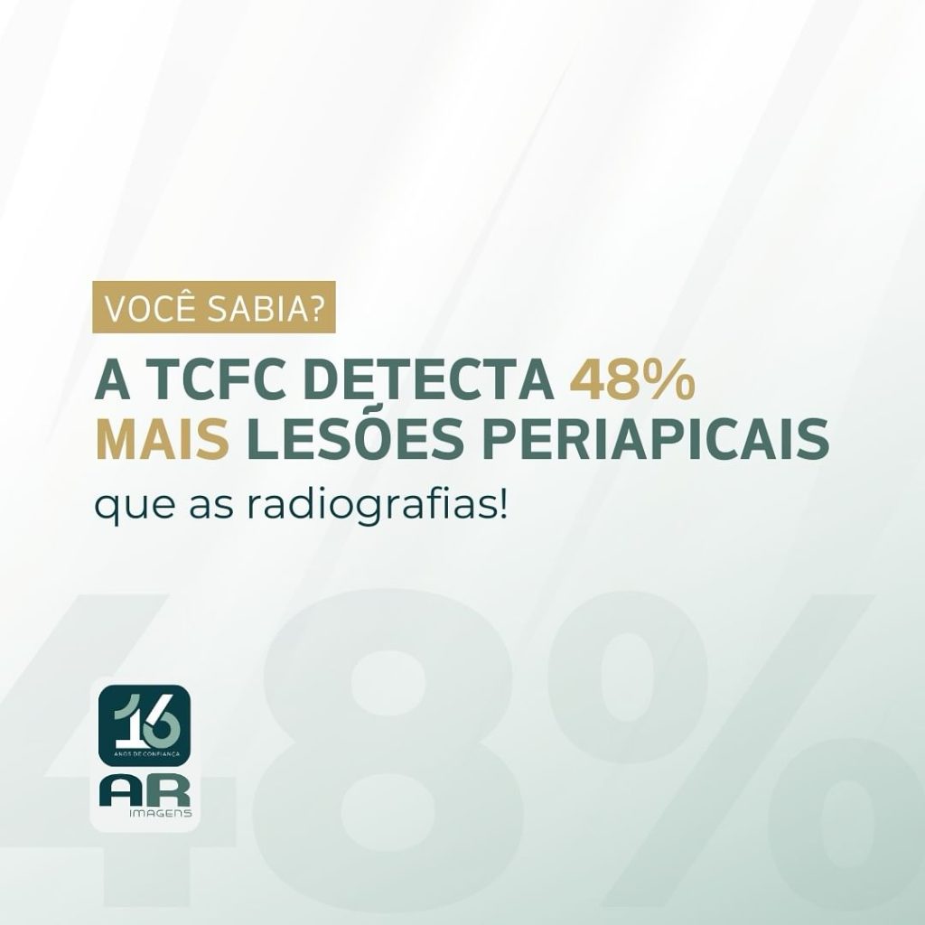 tomografia-computadorizada-de-feixe-conico-tcfc