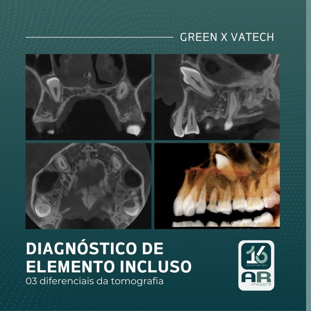 diagnostico-de-elemento-incluso