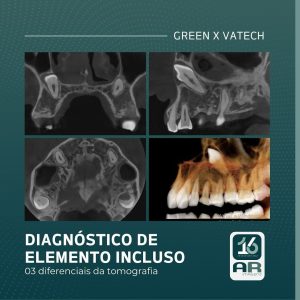 diagnostico-de-elemento-incluso