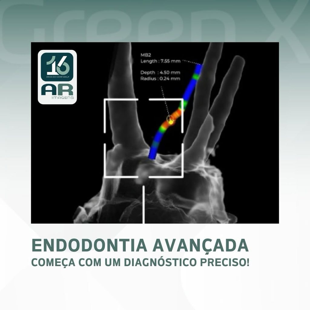 endodontia-avancada