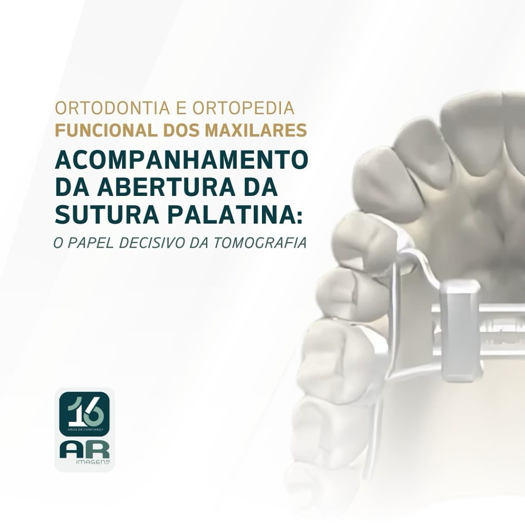 acompanhamento-da-abertura-da-sutura-palatina